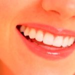 歯の着色の原因はなんだろう?