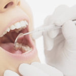 根面齲蝕（こんめんうしょく）ってなに？～予防と発症の原因～