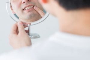 口の中にカビが生える？！
