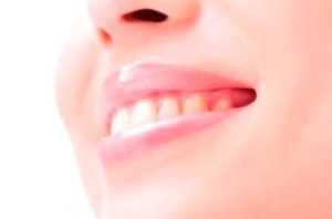 「噛みしめ」って？