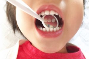 小児歯科って、何歳から何歳まで?