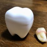 親知らずが斜めに生えてきた！放っておいて大丈夫？！