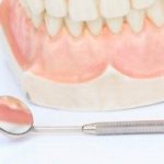 歯茎からの出血が招く恐ろしい病