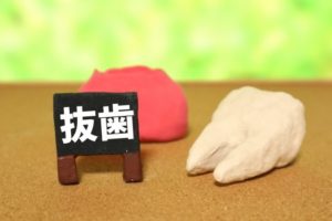 親知らずの抜歯～注意することはあるの？～