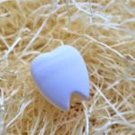 治療の跡が目立たない？！～ダイレクトボンディングってなに？～