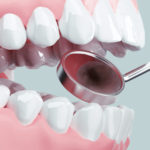 身元特定に重要な役割~警察歯科医って?~